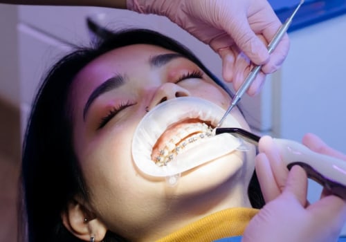 Choosing The Best Orthodontist In San Antonio: A Guide To Finding Expertise In Medical Imaging